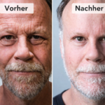 Jenke Vorher Nachher